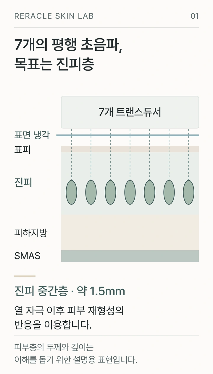 7개의 평행한 초음파가 진피 중간층을 데우는 원리와 표면 냉각을 보여주는 그림